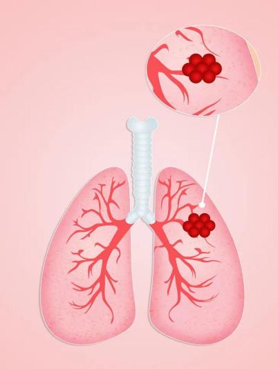 肺1.jpg