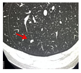 1638756980(1).jpg 1638756980(1).jpg