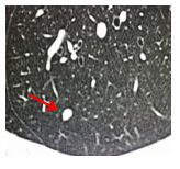 1638757000(1).jpg 1638757000(1).jpg