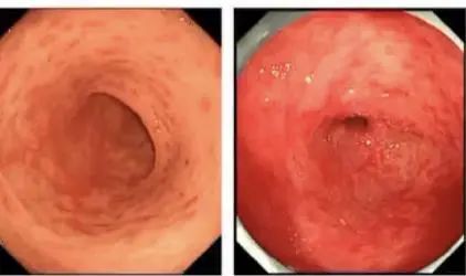 微信圖片_20220609082550.jpg 微信圖片_20220609082550.jpg