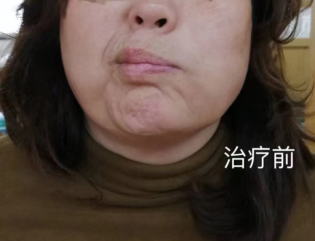 圖片 1.png 圖片 1.png