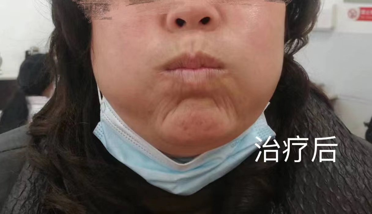 圖片 2.png 圖片 2.png